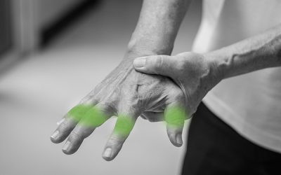 Arthritis – what actually is it?